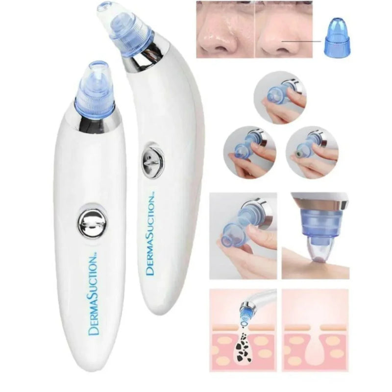 Removedor de Cravos Facial Dermasuction Wireless – Limpeza Profunda e Skincare Sem Fio