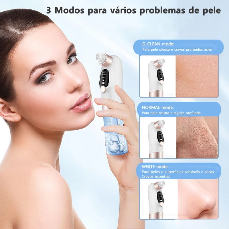 Removedor de cravo poros aspirador facial elétrico espinha Usb recarregável