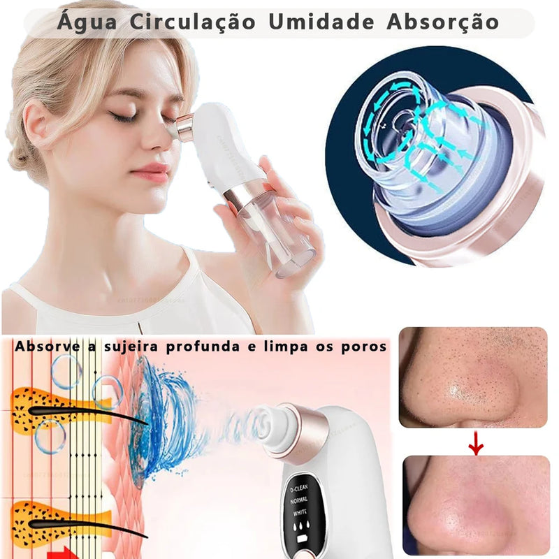 Removedor de cravo poros aspirador facial elétrico espinha Usb recarregável